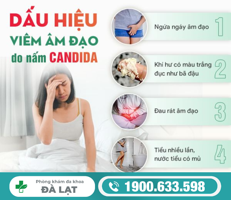 Hình ảnh minh họa